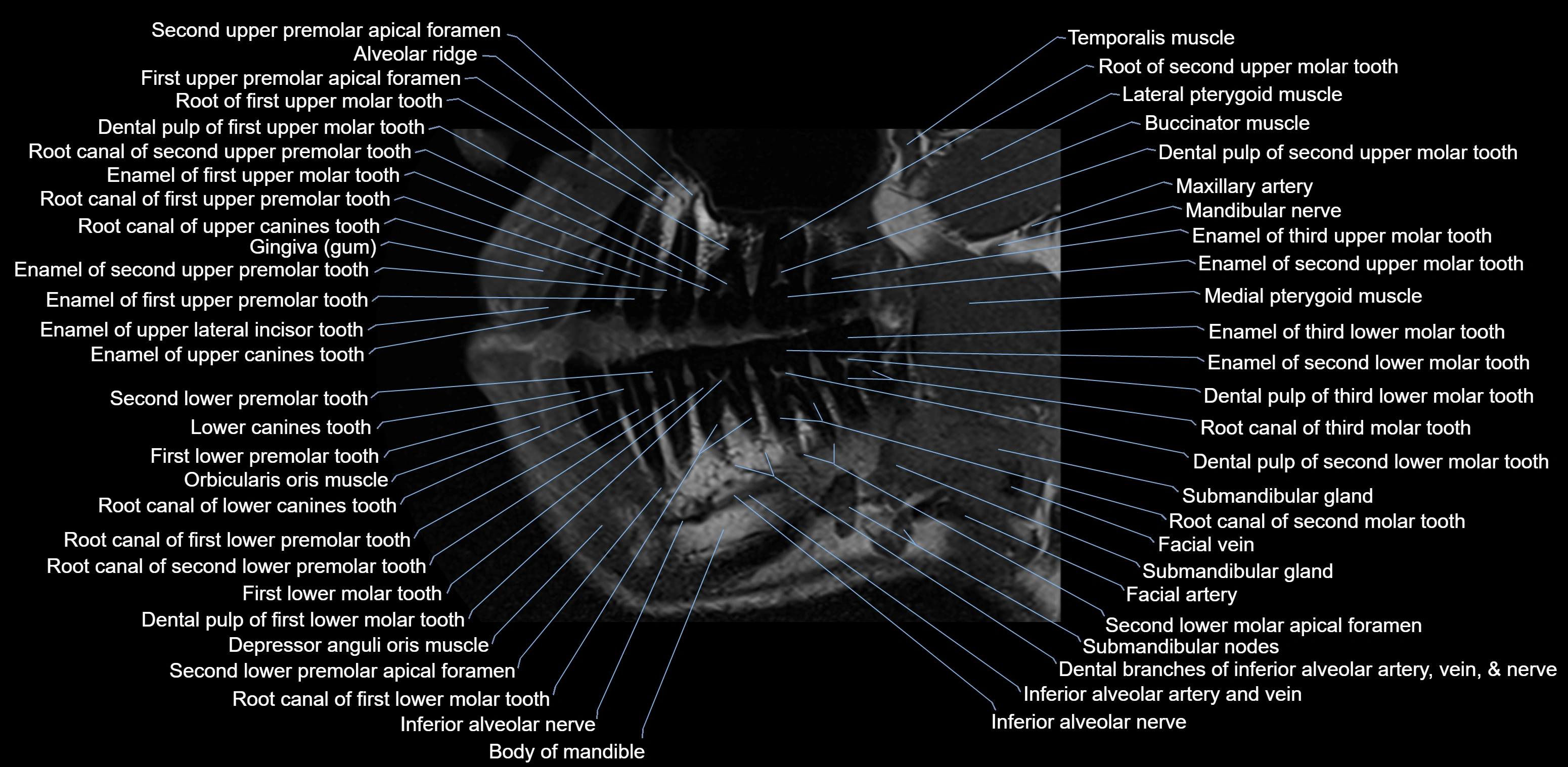 Dental MRI( tooth) sagittal labelled  cross sectional 3T anatomy -img-00001-00007.webp
